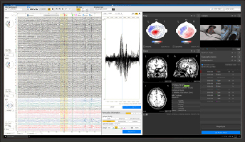 画像：脳磁計測システム RICOH MEG